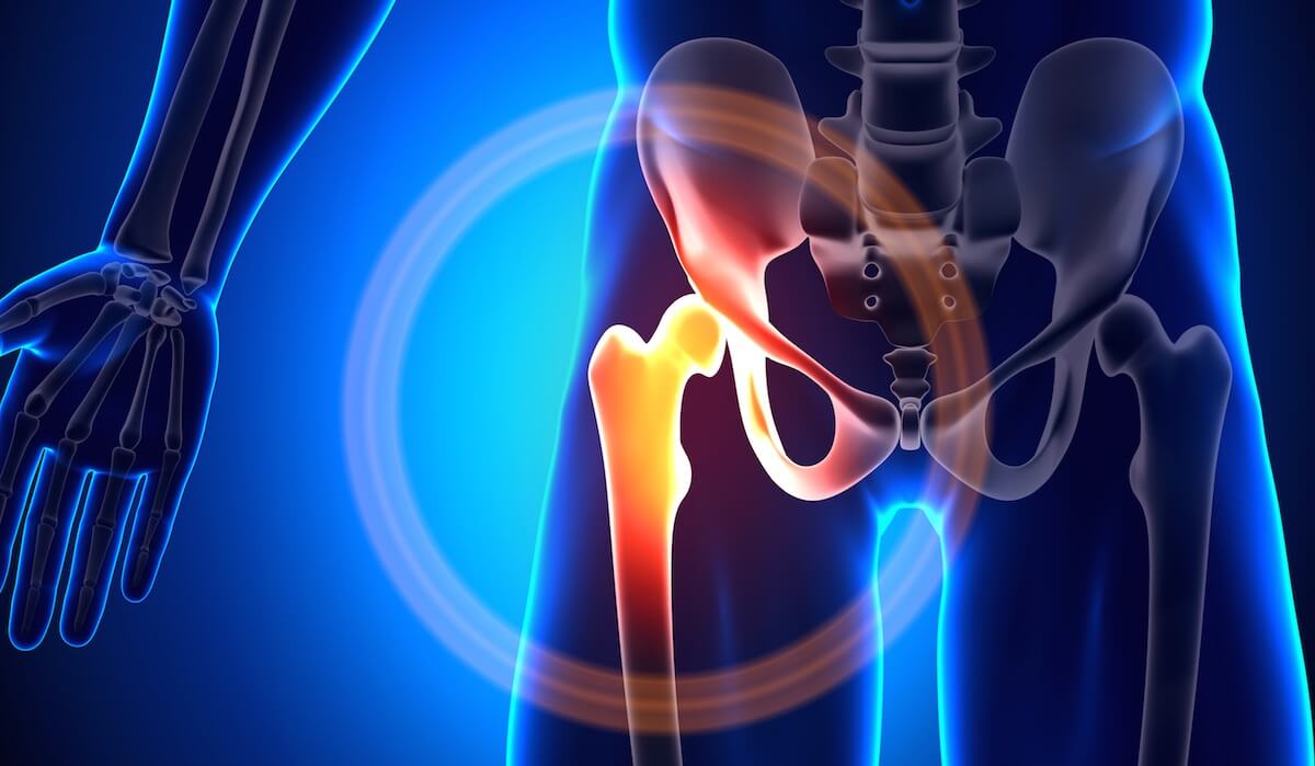 درمان‌های غیرجراحی پوبالژیای کمر
