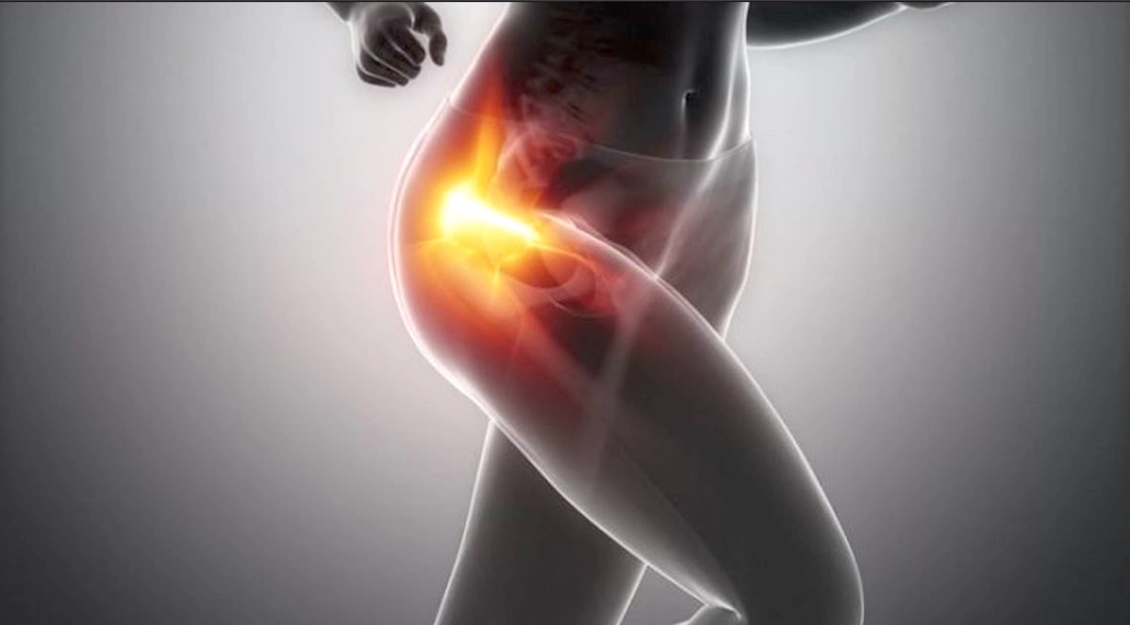 بیماری روابط جنسی پوبالژیا