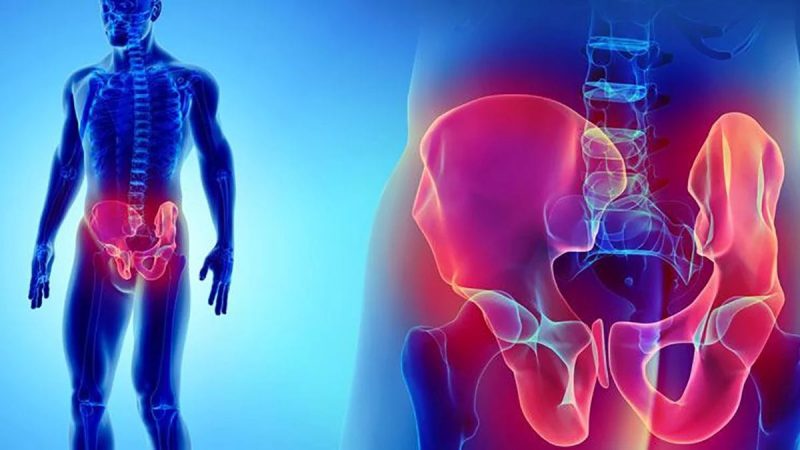 دلایل شایع پوبالژیا