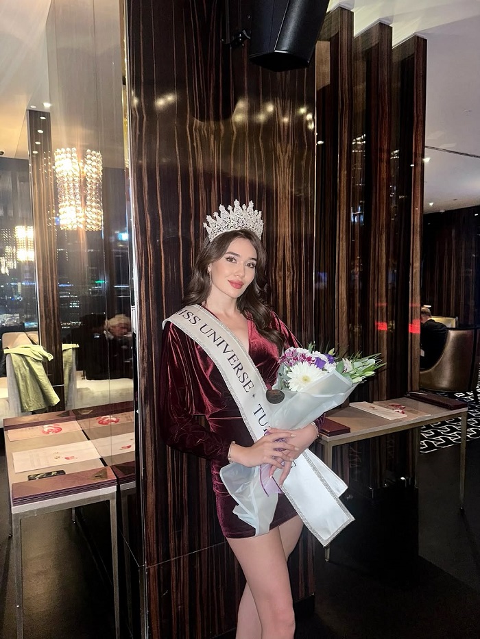 نماینده زیبایی ترکیه 2025