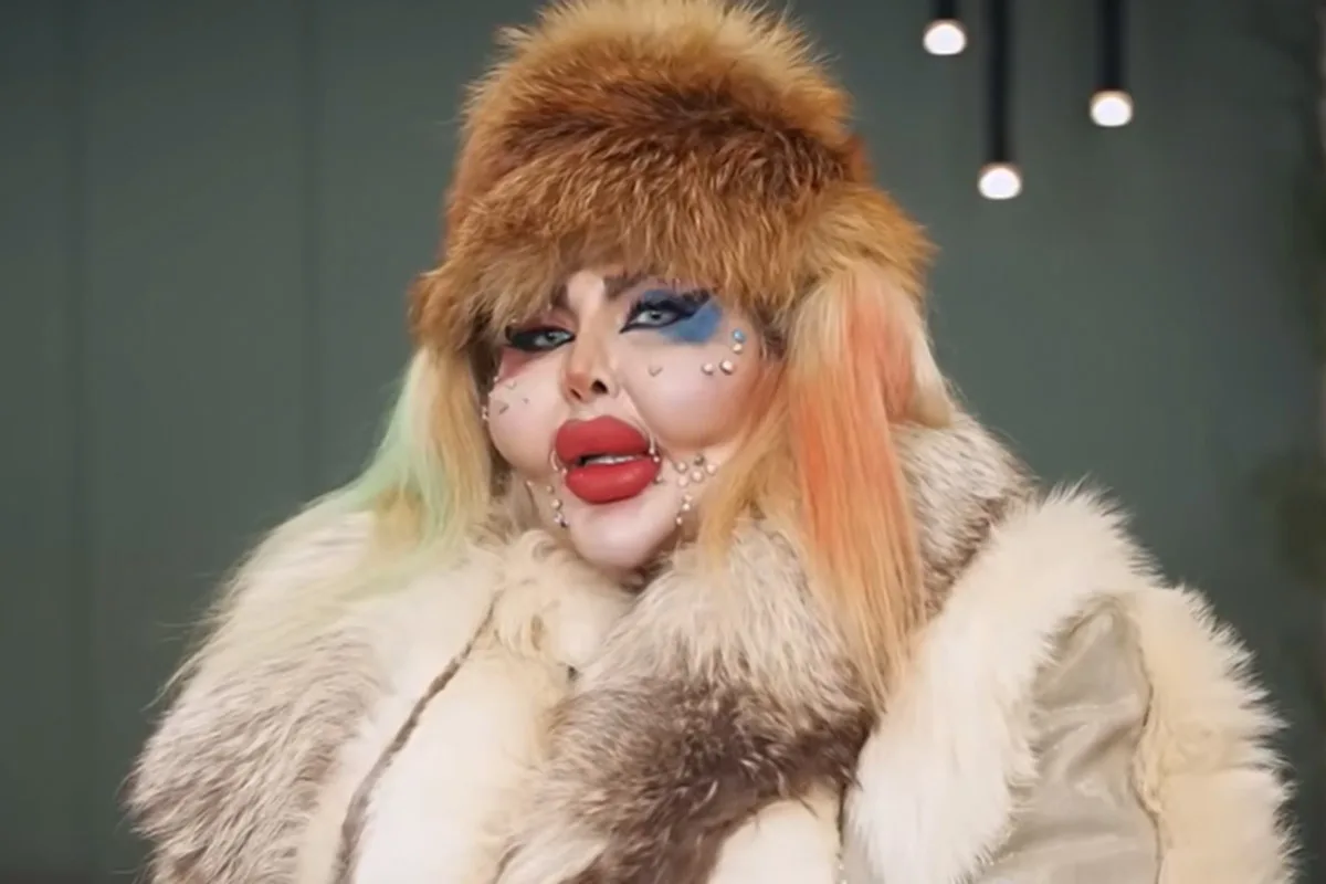 آناهیتا ناچو و جراحیهای متعدد زیبایی