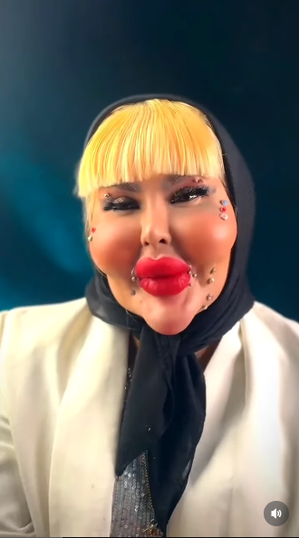 عکس آناهیتا ناچو 