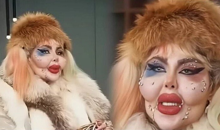 عکس آناهیتا ناچو قبل از عمل